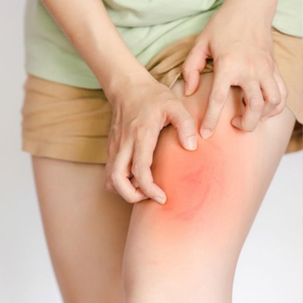 Vulvar pain & itching measures