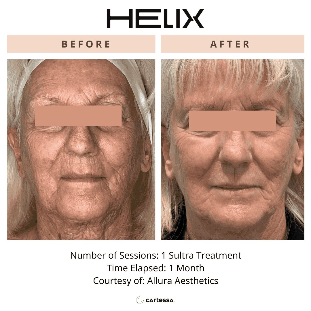 Helix13169766352468-enchanted